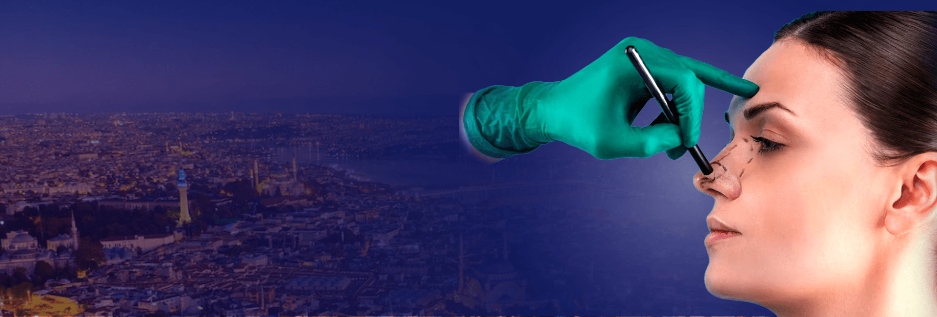 Treatment Rhinoplasty Surgery