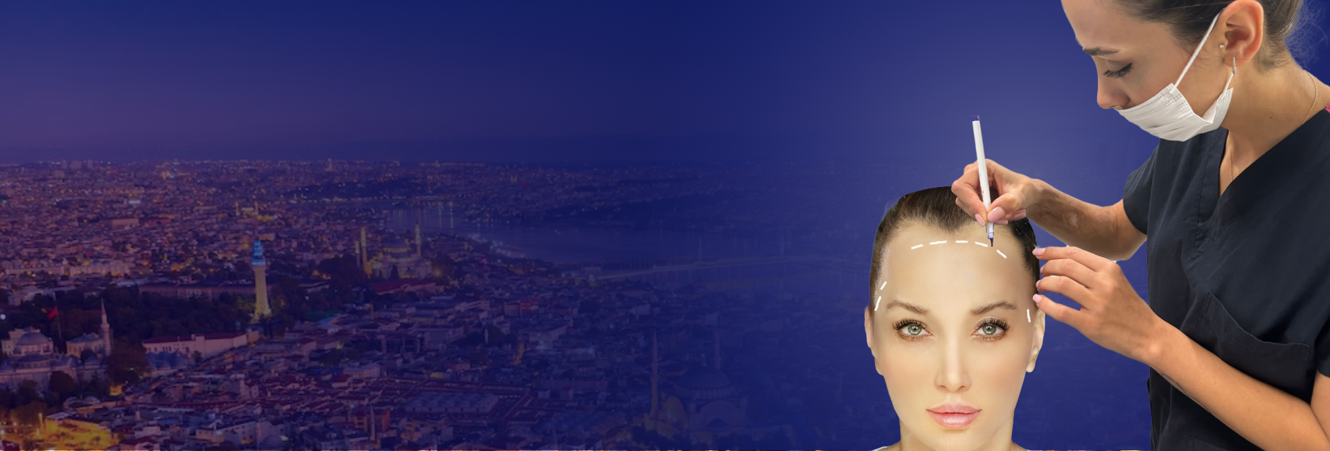 Treatment Hair Transplant – Female Hair Transplant