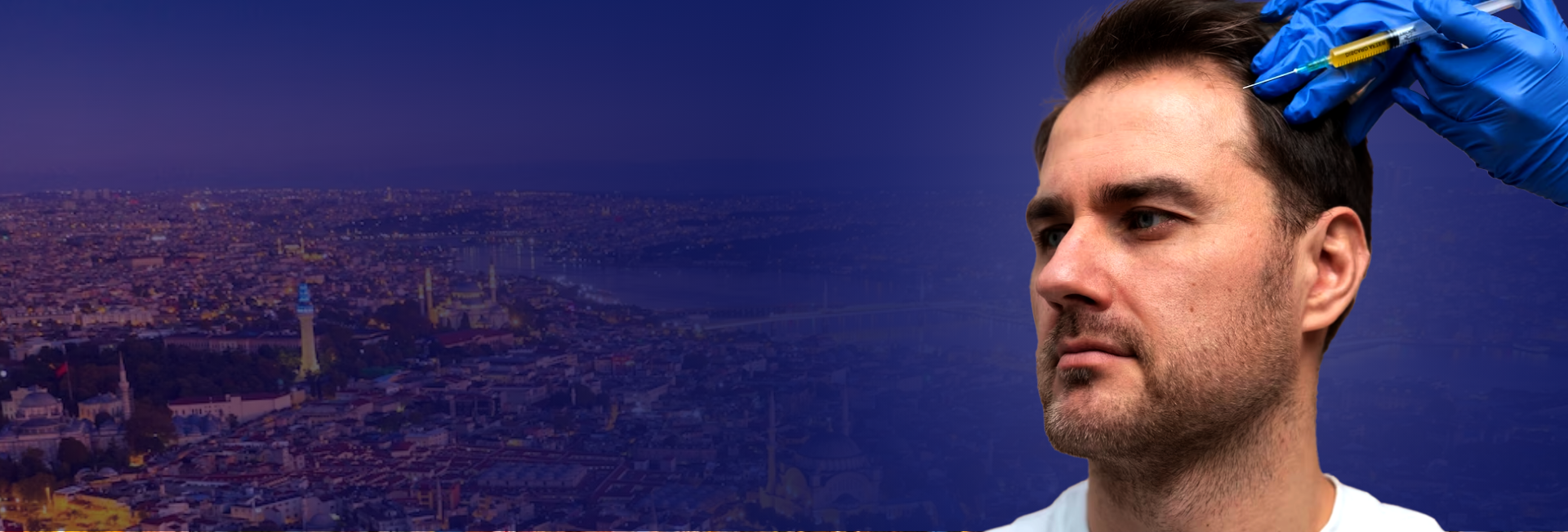 Treatment Hair Transplant – Hair PRP