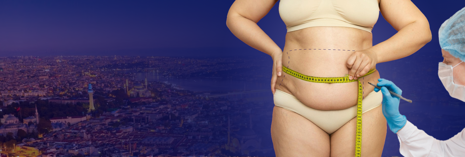 Treatment Obesity Surgery
