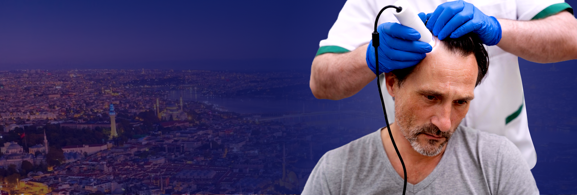 Treatment Hair Transplant – Hair Mesotherapy