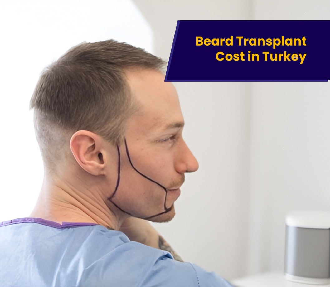 Beard Transplant Cost Turkey 2026