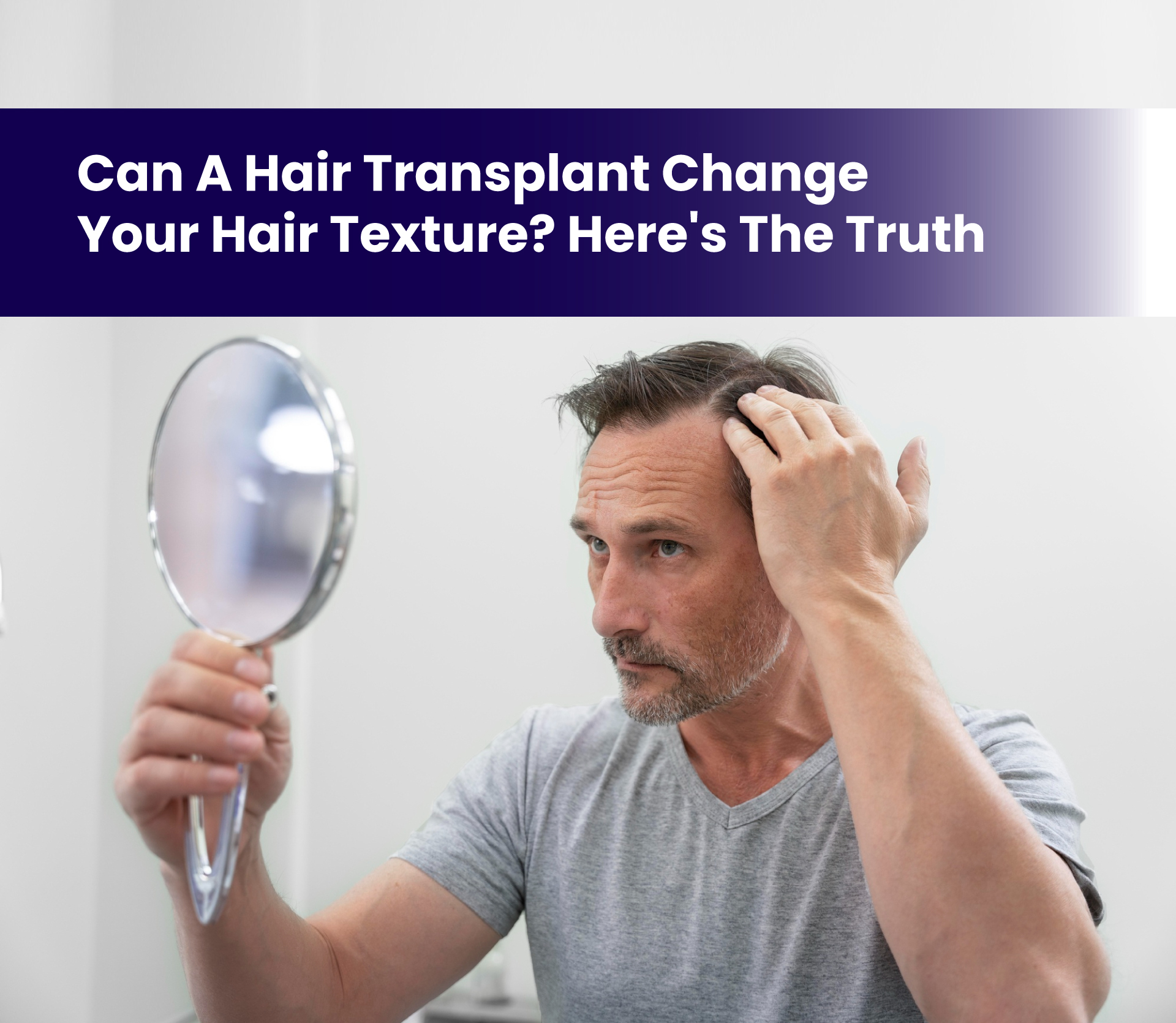 Can a Hair Transplant Change Your Hair Texture? Here’s the Truth