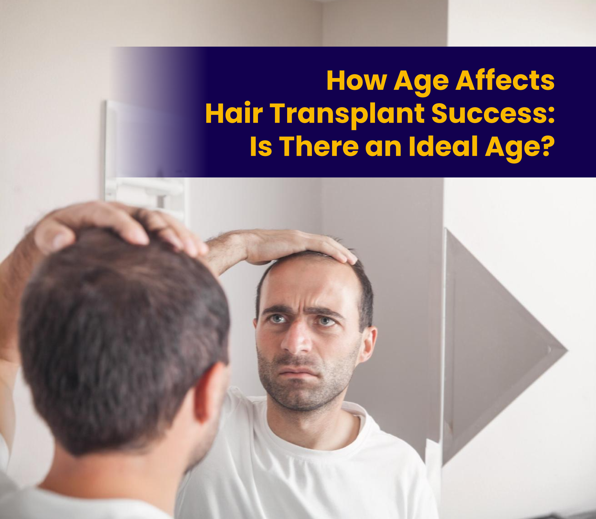 How Age Affects Hair Transplant Success: Is There an Ideal Age?