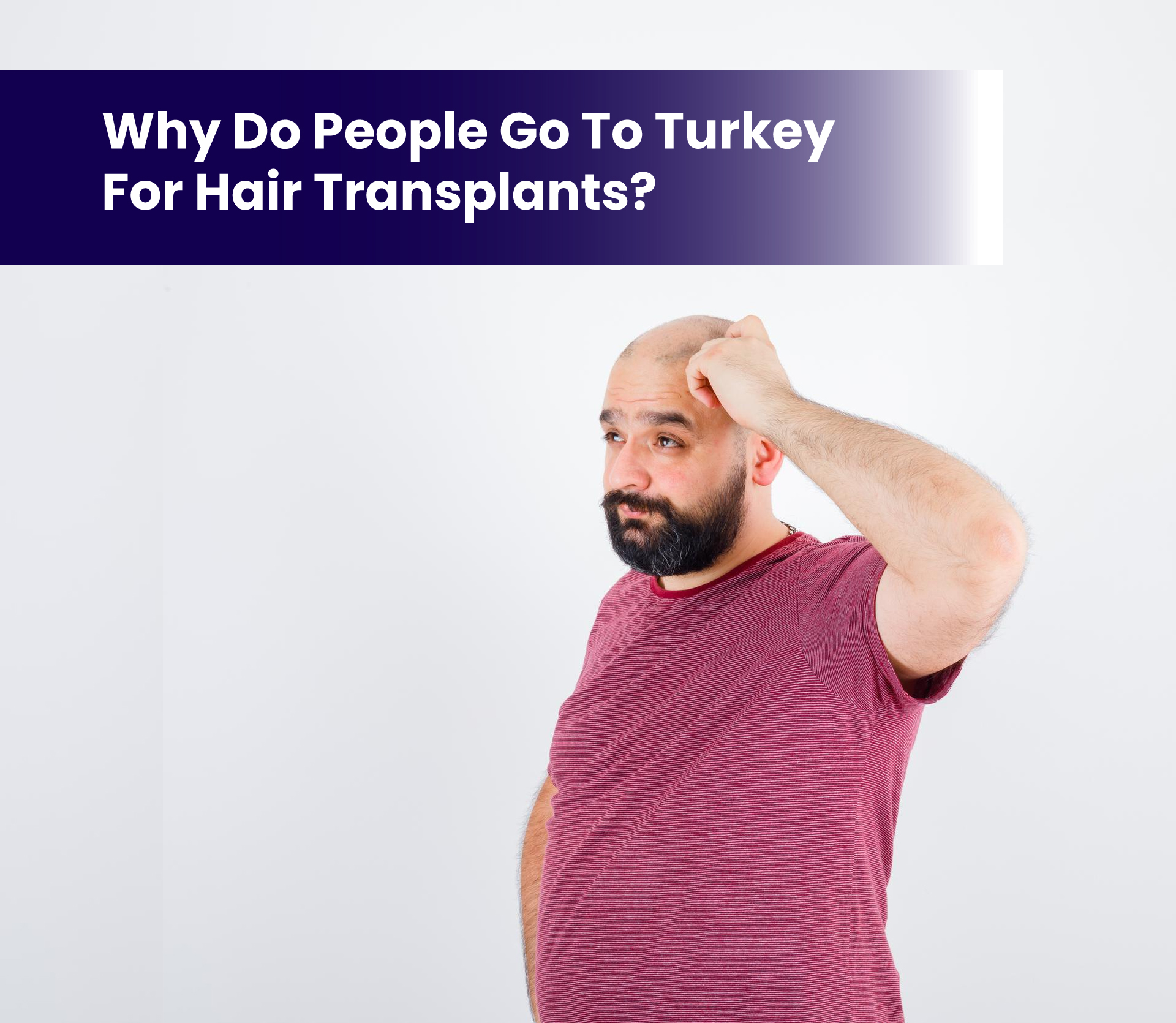 Why Do People Go to Turkey for Hair Transplants?