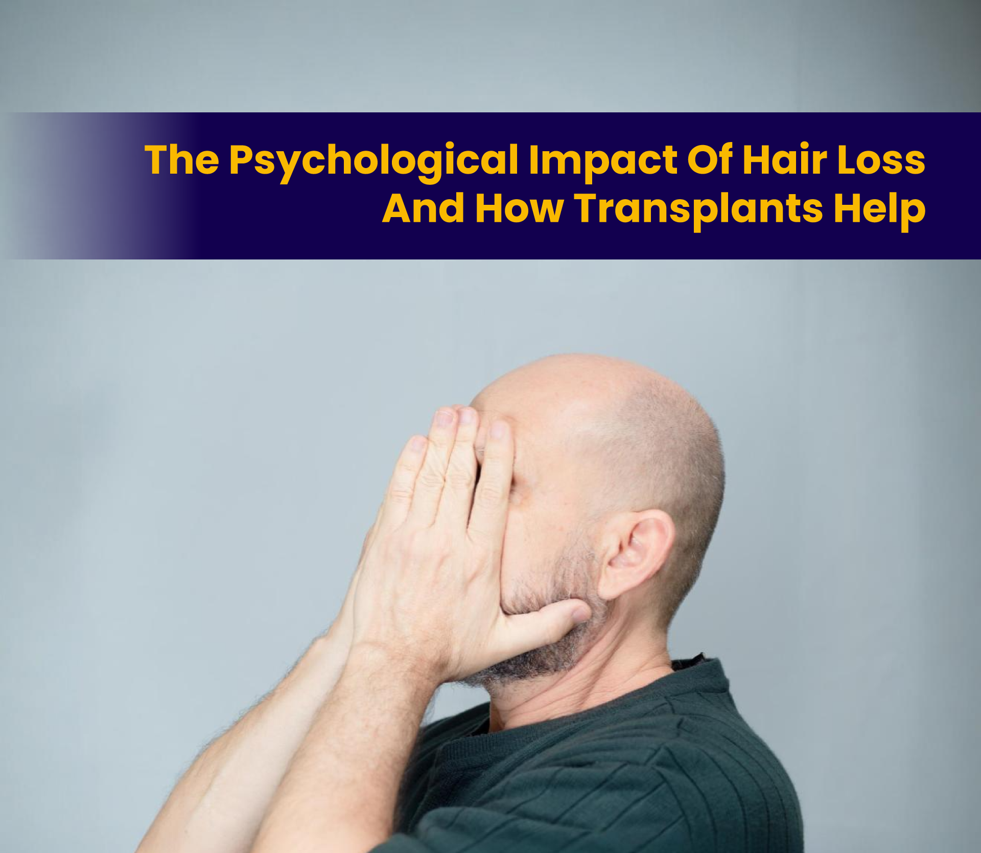 The Psychological Impact of Hair Loss and How Transplants Help