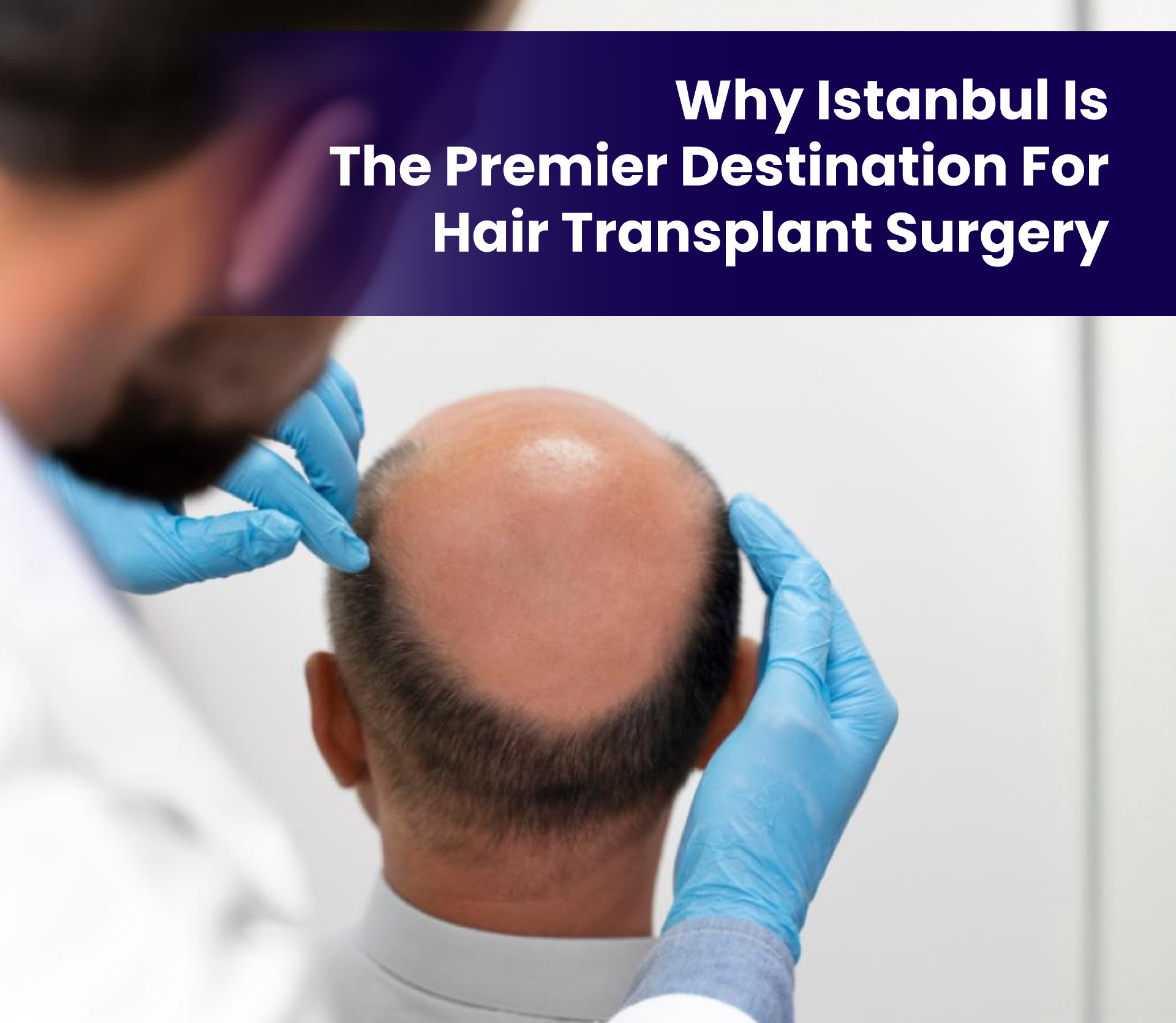 Why Istanbul is the Premier Destination for Hair Transplant Surgery