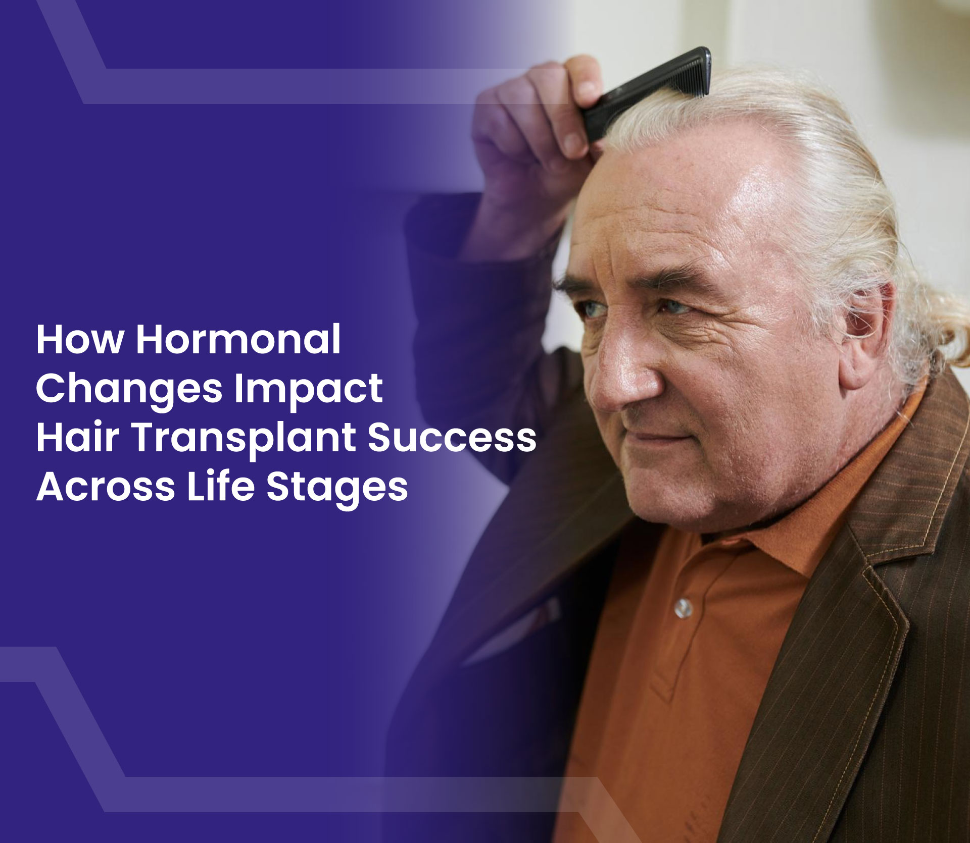 How Hormonal Changes Impact Hair Transplant Success Across Life Stages
