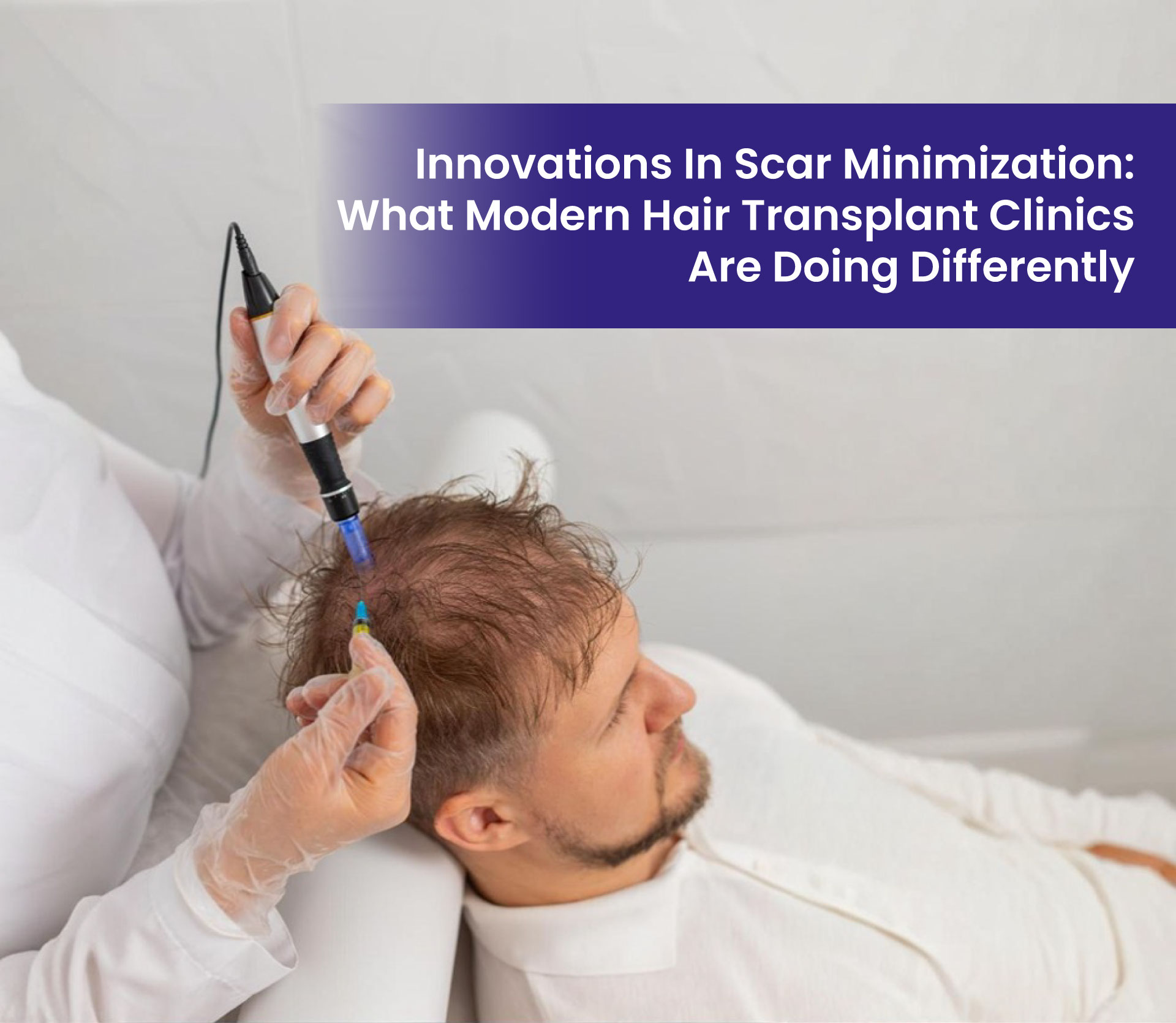 Innovations in Scar Minimisation: What Modern Hair Transplant Clinics Are Doing Differently