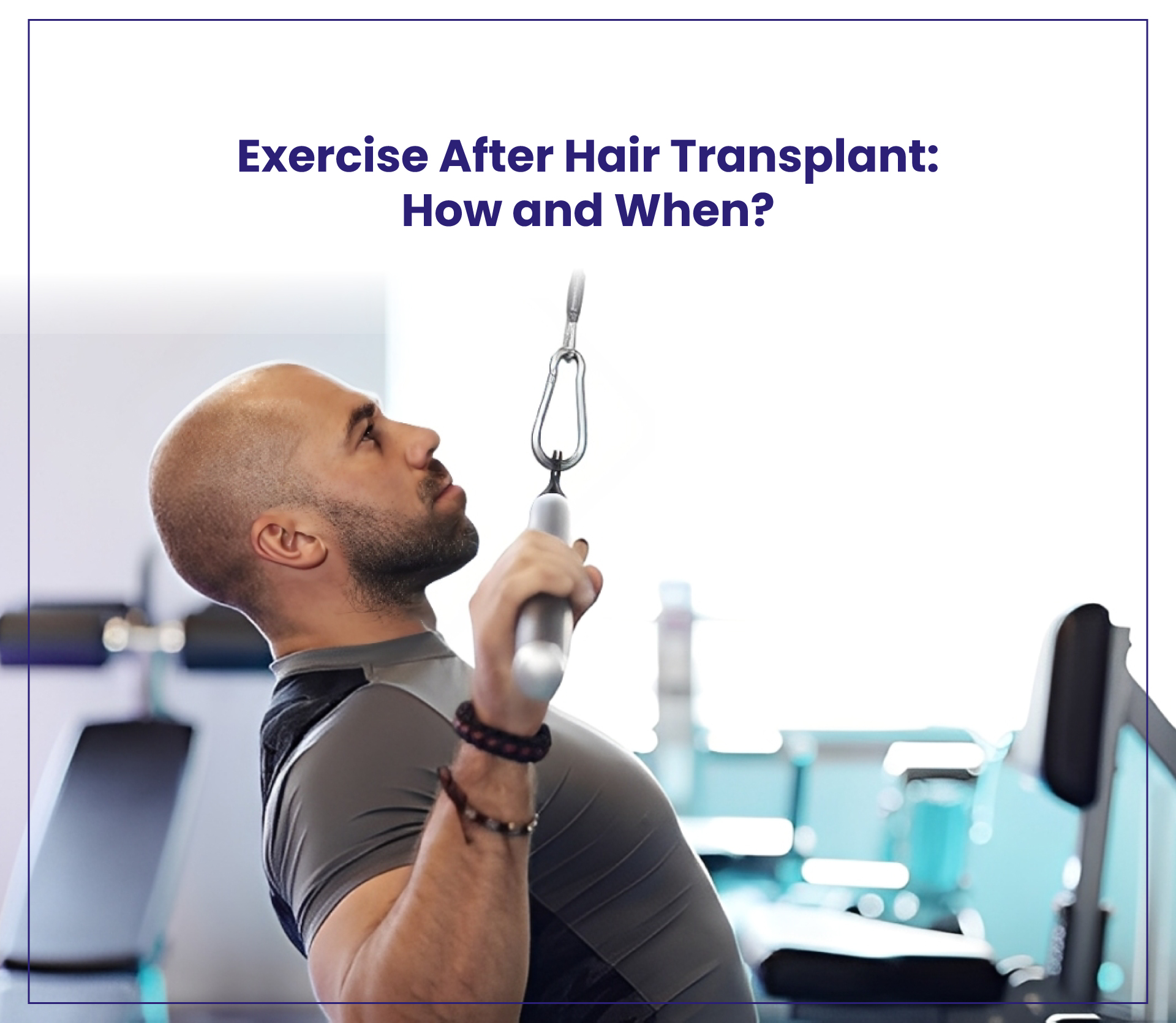 Exercise After Hair Transplant: How and When?